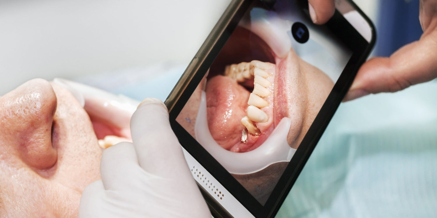 Revolutionizing Dental Photography with Smartphones