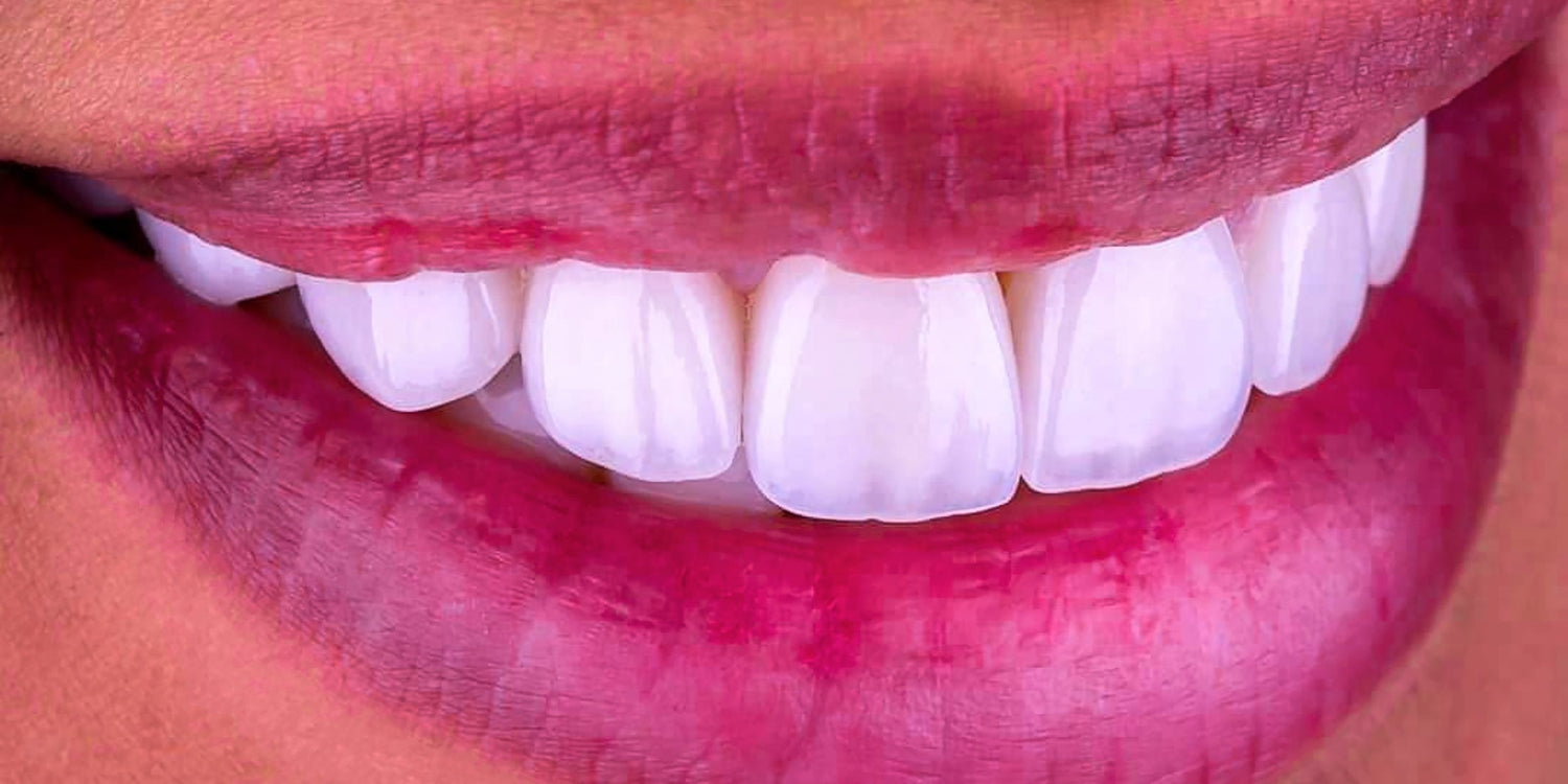 Why Do You Need Dental Photography