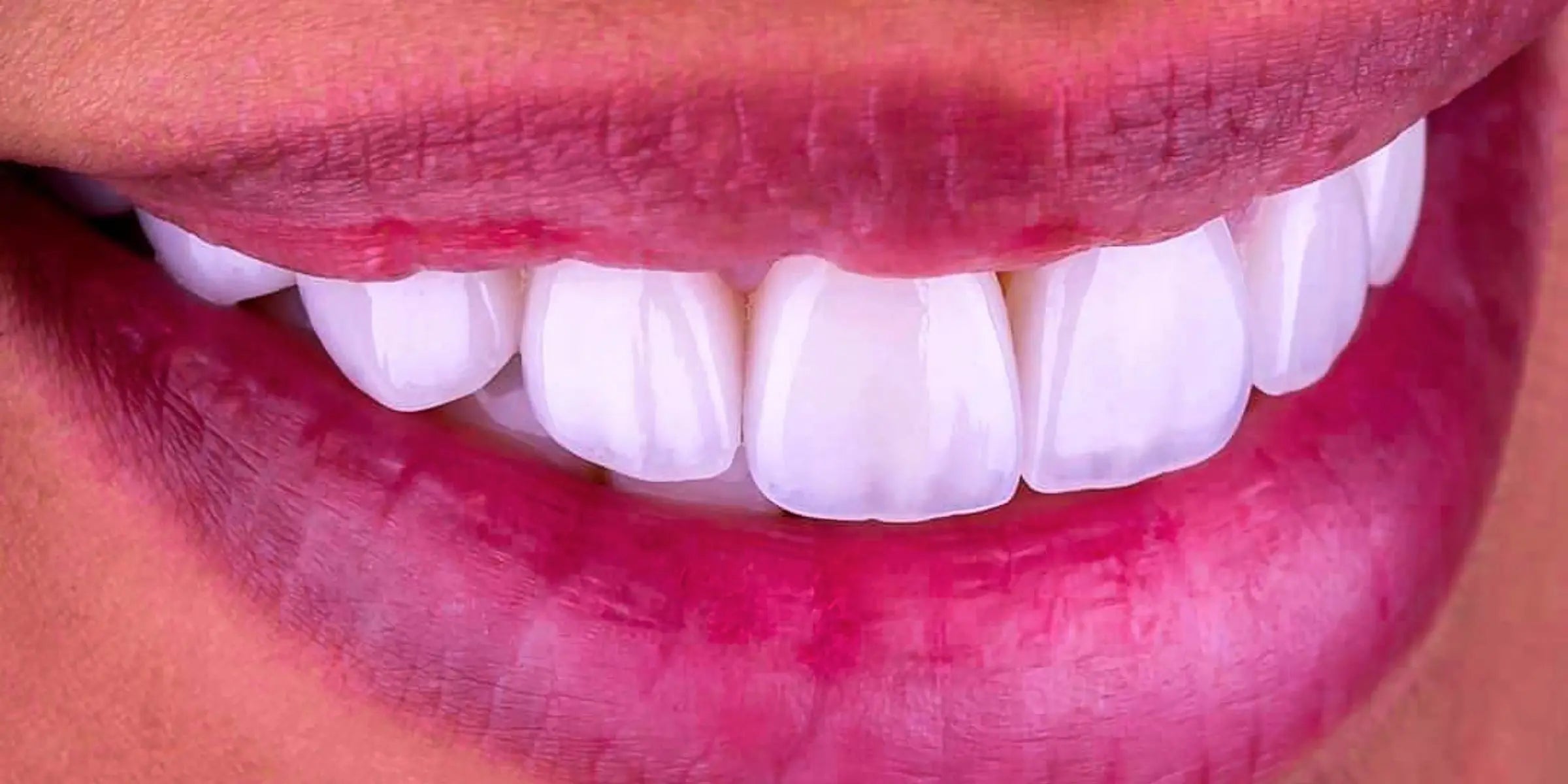 Why Do You Need Dental Photography Dentiphoto