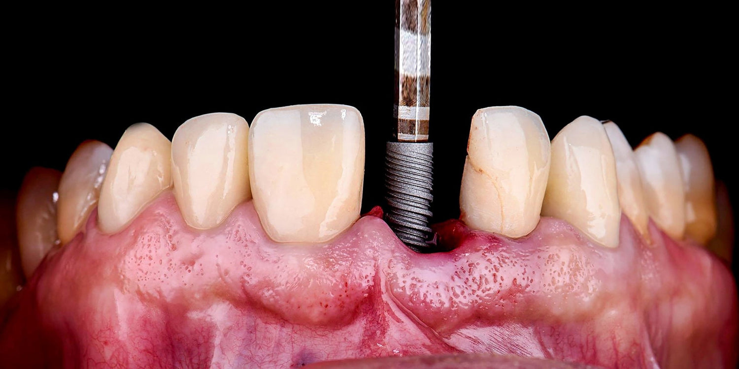 Elevate Your Dental Photography: Essential Tools and Tips Dentiphoto