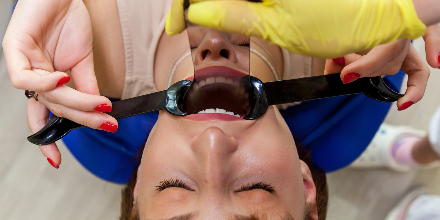 Soft Tissue Retractors: An Essential Tool for Dental Photography Dentiphoto