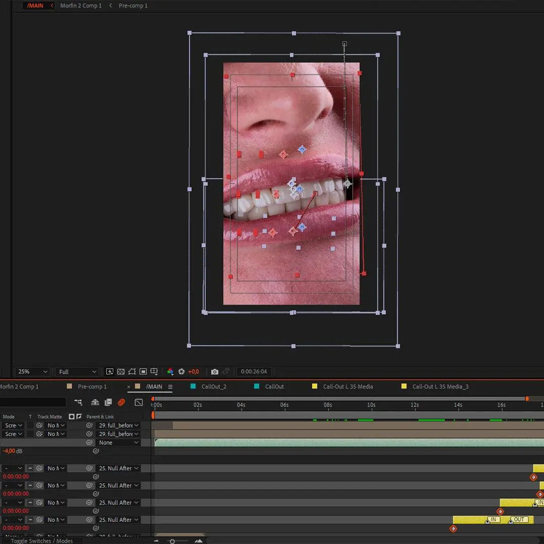 Diseño de movimiento dental A-Z en After Effects (Español) Dentiphoto