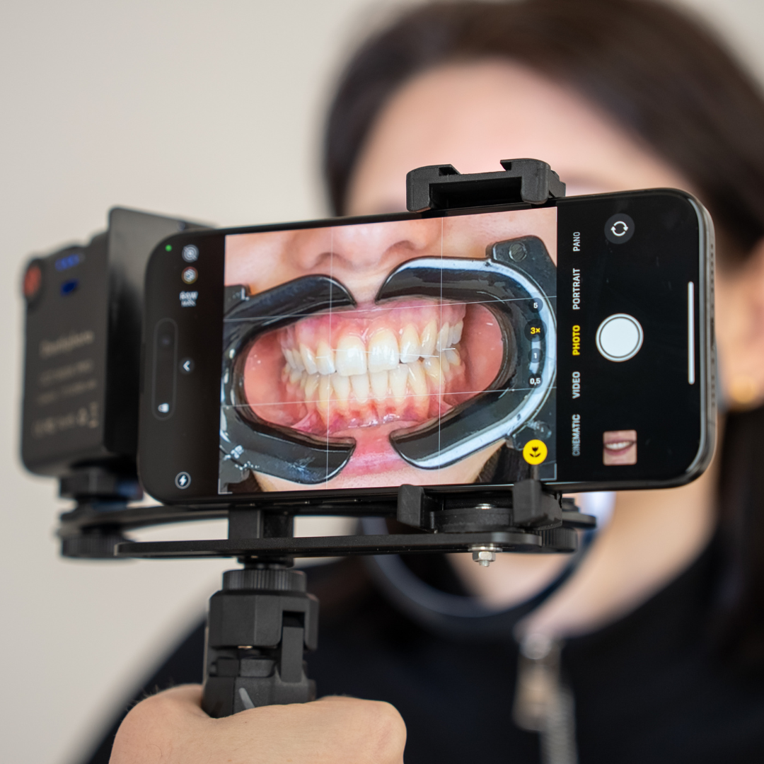NEU! Dentiphoto Mobile Twin Light für die Dentalfotografie