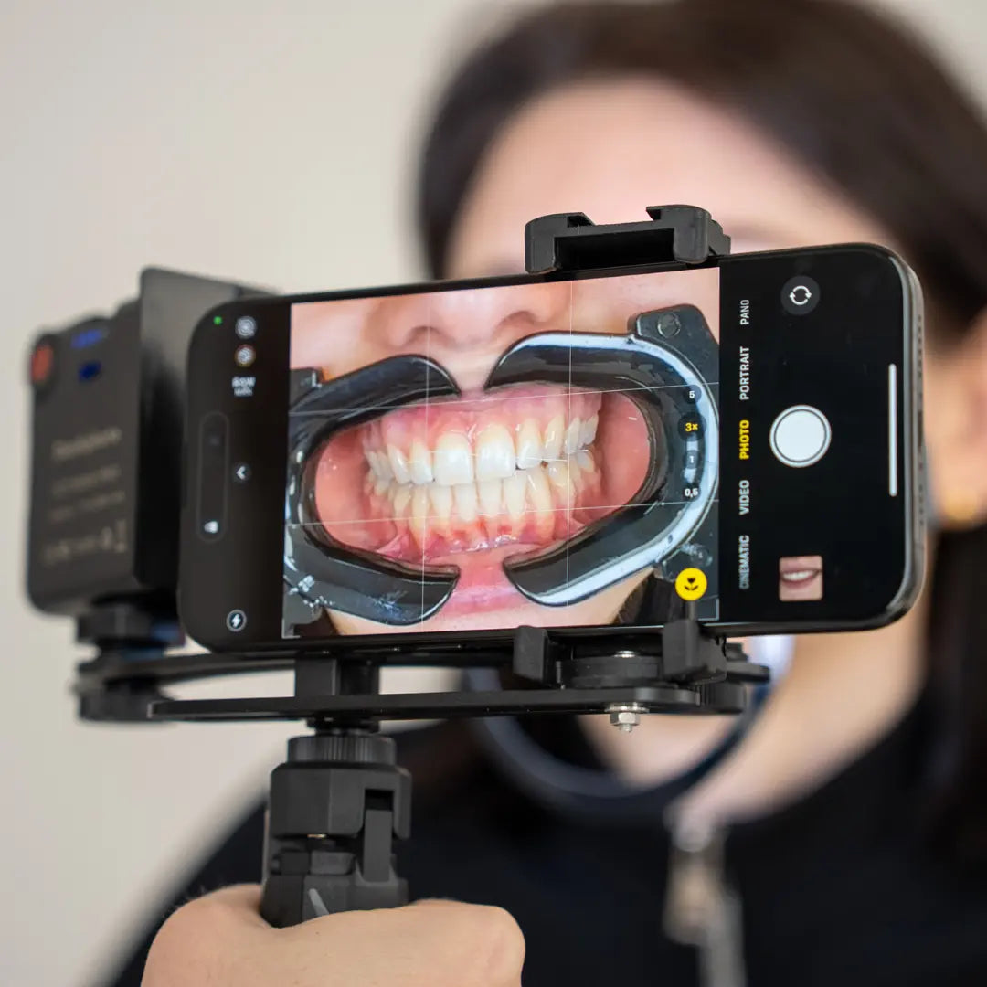 NEW! Dentiphoto Mobile Twin Light for Dental Photography Dentiphoto