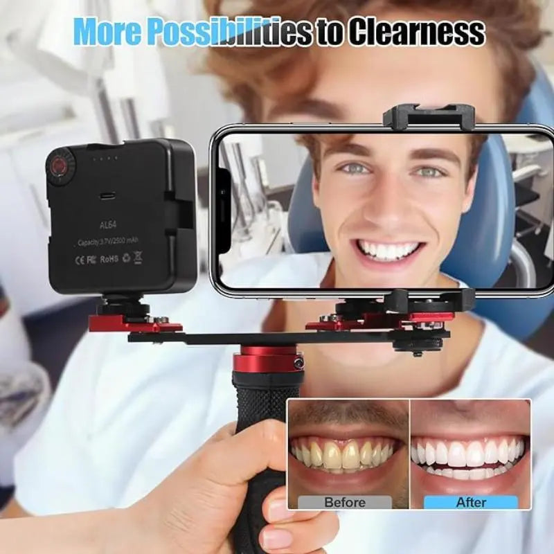 Twin Light For Mobile Dental Photography and Accessories Dentiphoto