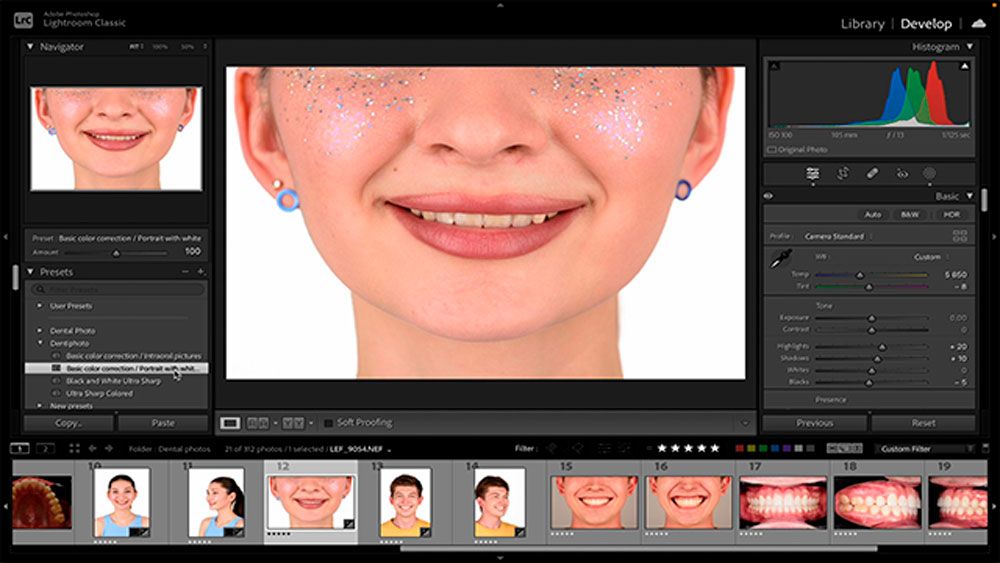Edición de fotografías dentales en Photoshop y Lightroom (Español)