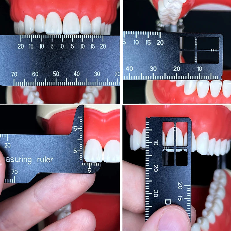 Regla de medición de precisión dental