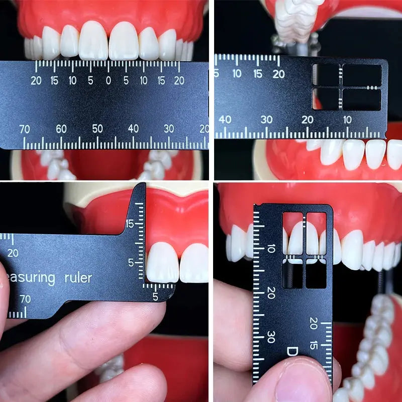 Dental Precision Measuring Ruler Dentiphoto
