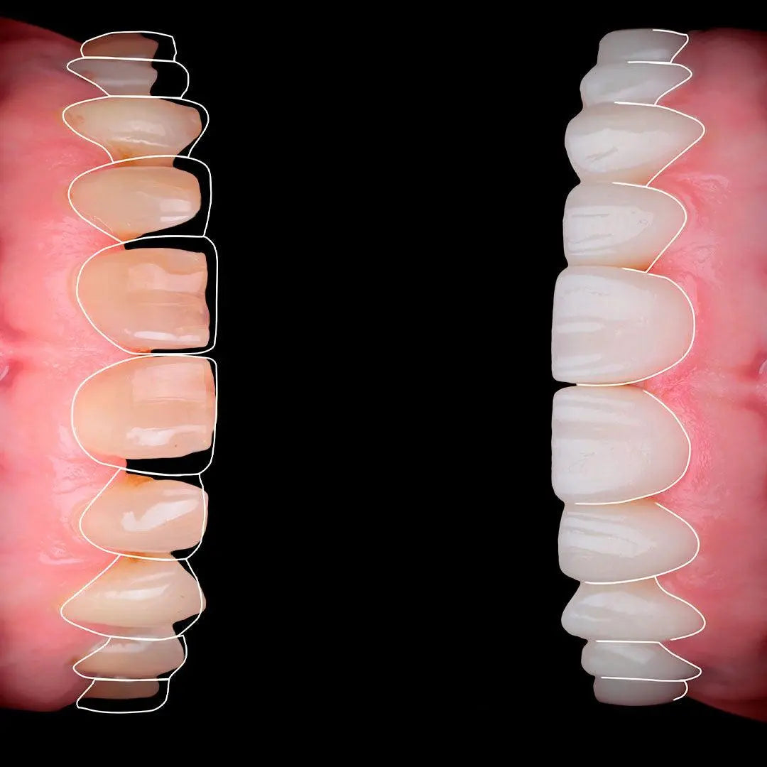 Diseño de movimiento dental A-Z en After Effects (Español) Dentiphoto