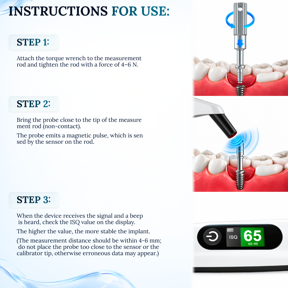 Dental Implant Stability Analyzer – AI-Powered RFA & ISQ