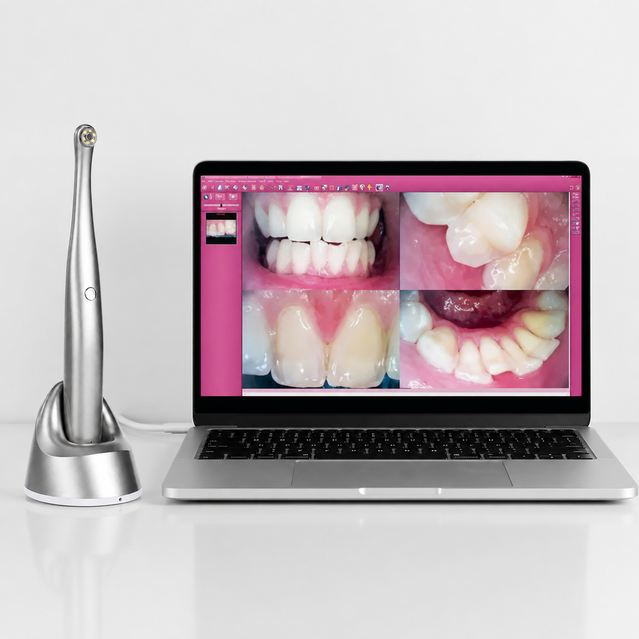 5MP Wireless Intraoral Camera with 2K HD Imaging & 5G Wi-Fi