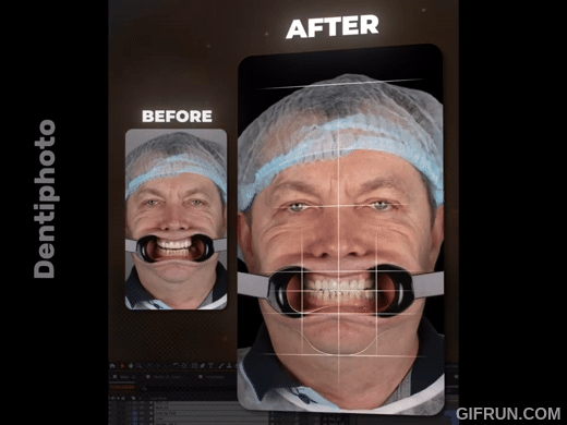 Course: Dental Motion Design A-Z or How to Create Animated Videos from Dental Photos (English)