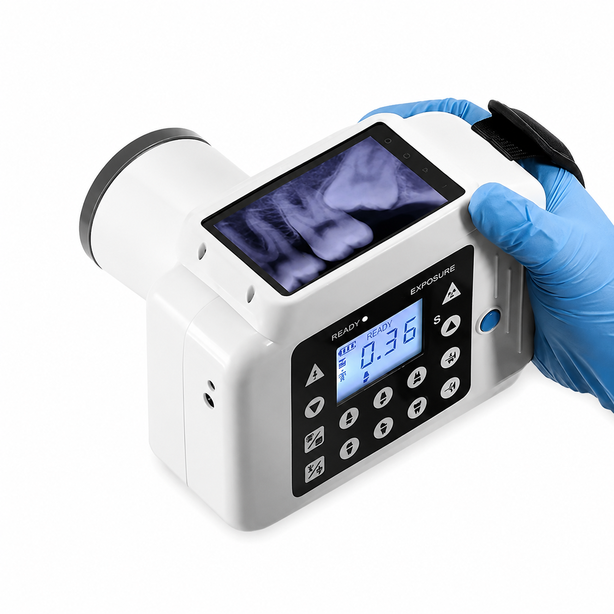 Portable Dental Digital X-Ray Unit with Instant Image Display