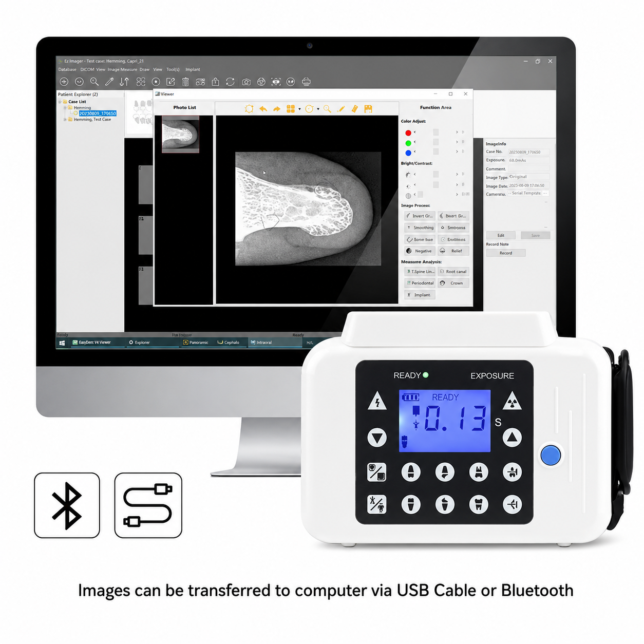 Portable Dental Digital X-Ray Unit with Instant Image Display