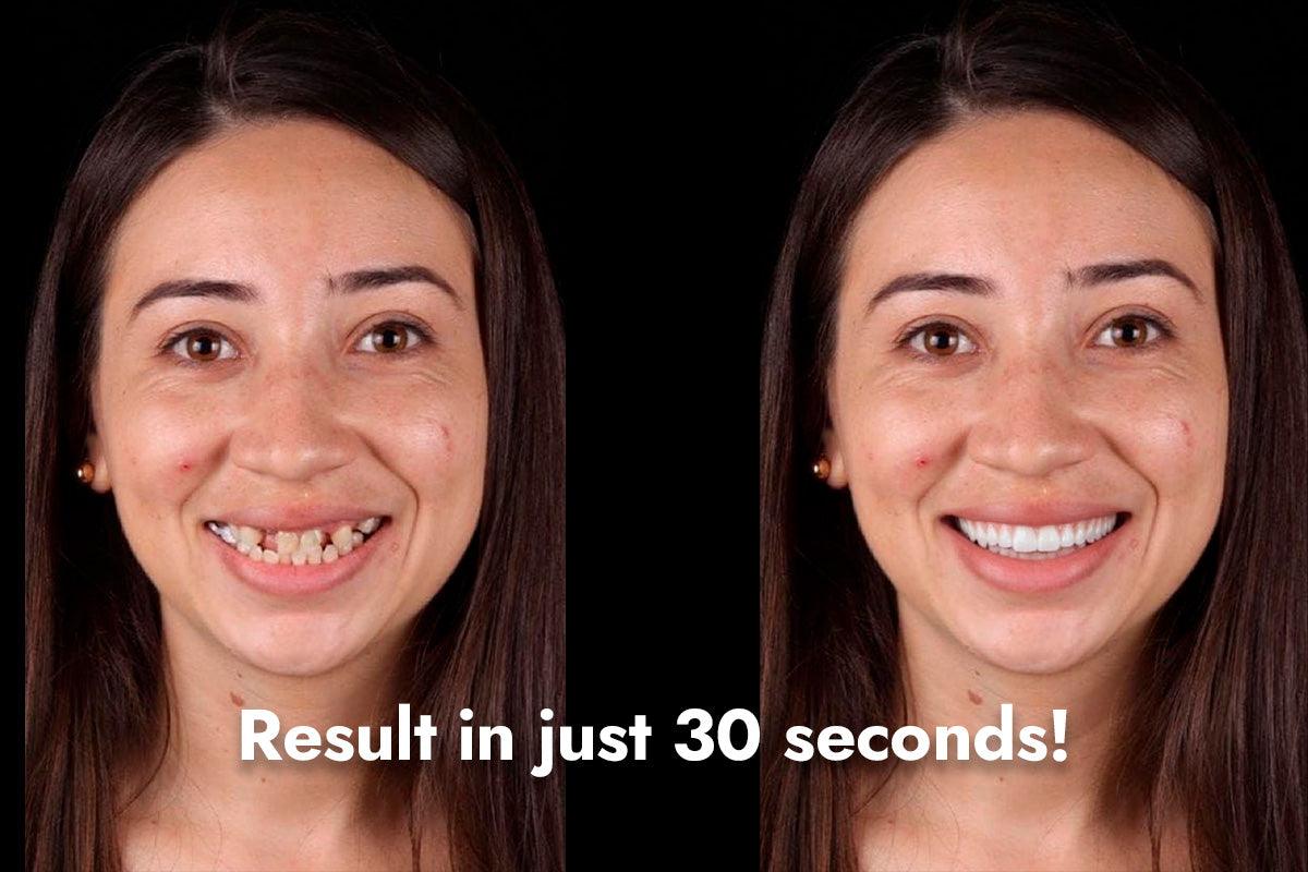 ¡Oferta especial! Créditos para la app Dentiphoto con un 50 % de descuento.