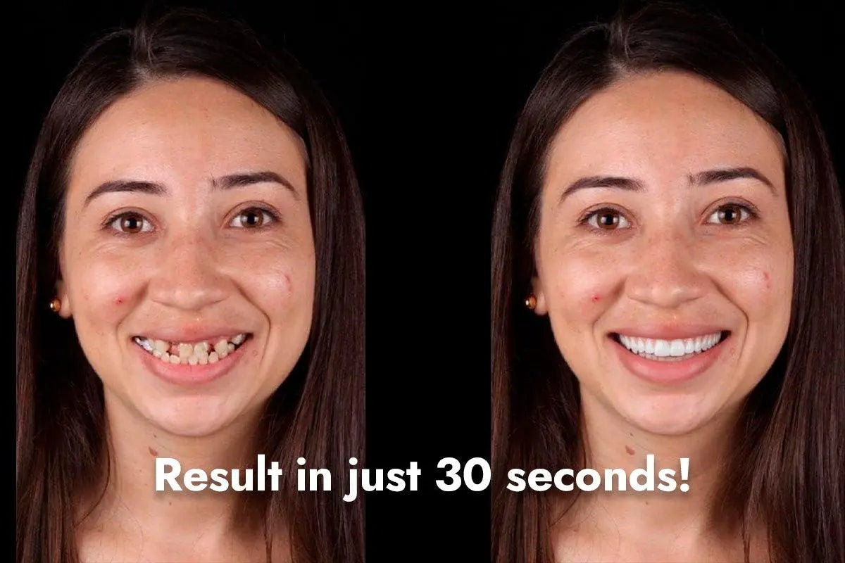 Special offer! Credits for Dentiphoto App with 50% discount! Christmas Offer Dentiphoto