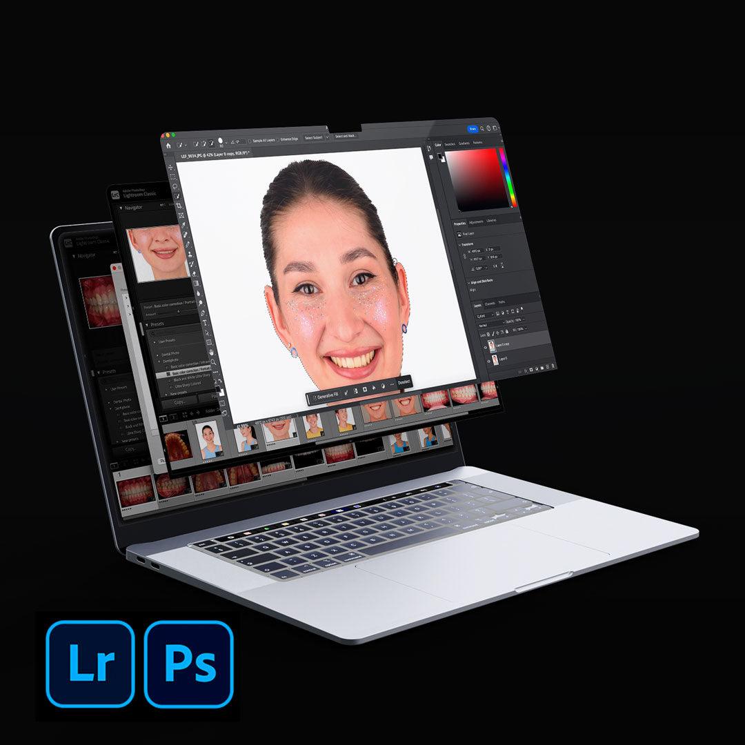 Curso: Secretos de la edición de fotografías dentales en Photoshop y Lightroom