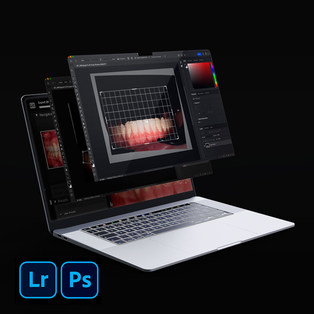 Editing dental photos in Photoshop and Lightroom (Eng)
