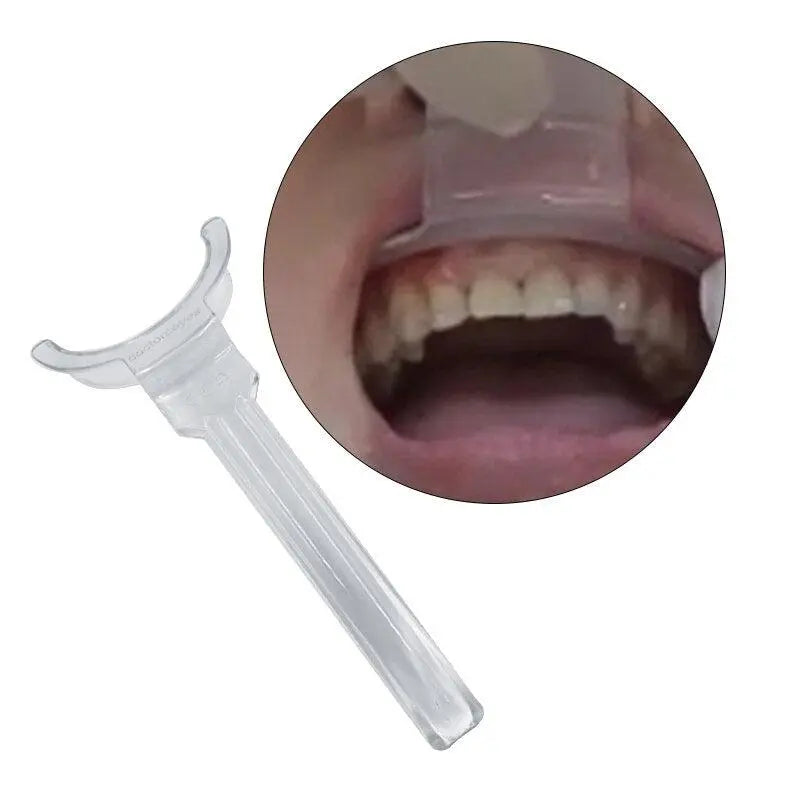 Upper and Lower Lip Retractor - Dentiphoto