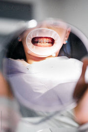 Mastering Dental Photography: Navigating the Exposure Triangle with Life Hacks