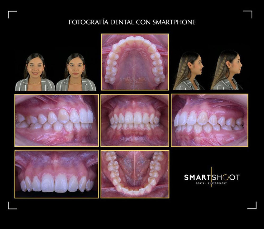Fotografía dental con el teléfono: recomendaciones de Said Díaz