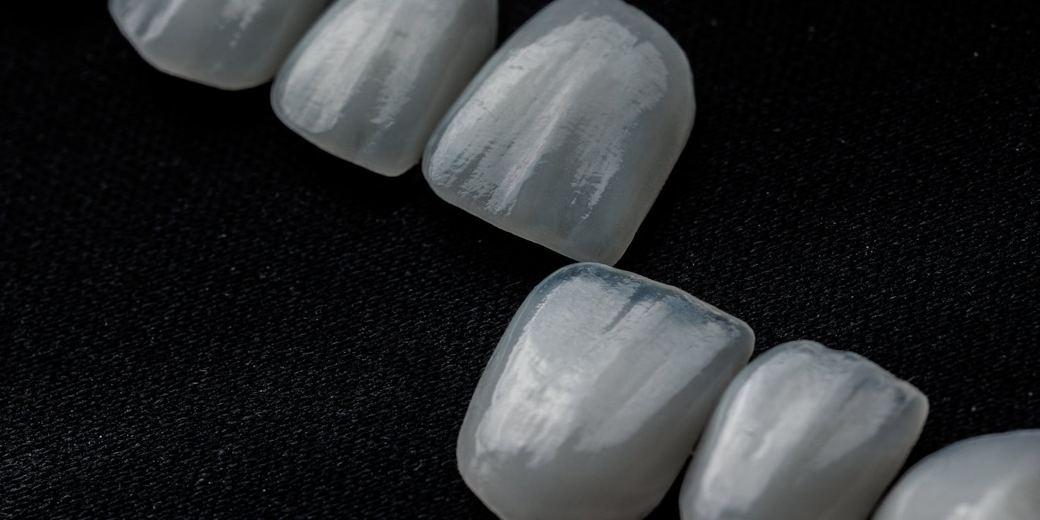 Benefits of Macro Photography in Dentistry