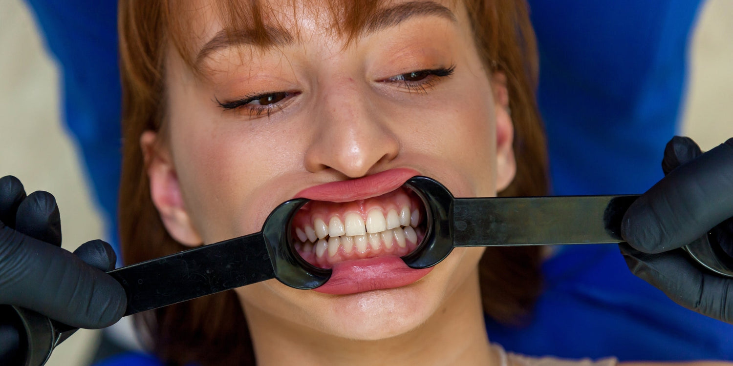 The Role of Retractors in Dental Photography: Clear vs. Black
