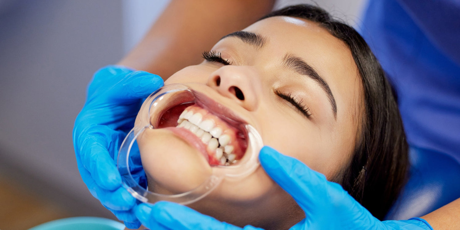 Essential Accessories for Dental Photography