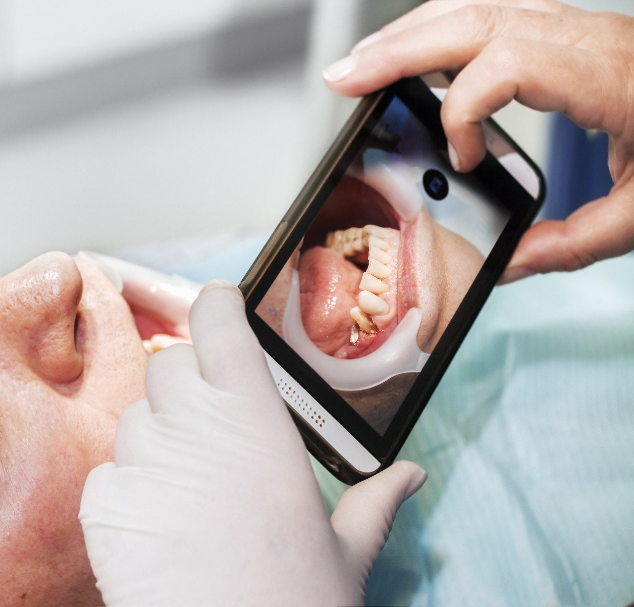 The Power of Dental Photography Using Your Smartphone: Unlocking the Potential with Advanced Accessories