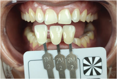 grey card dentistry