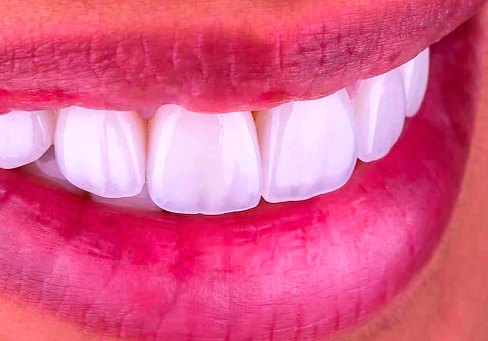 Dental Photography Blog