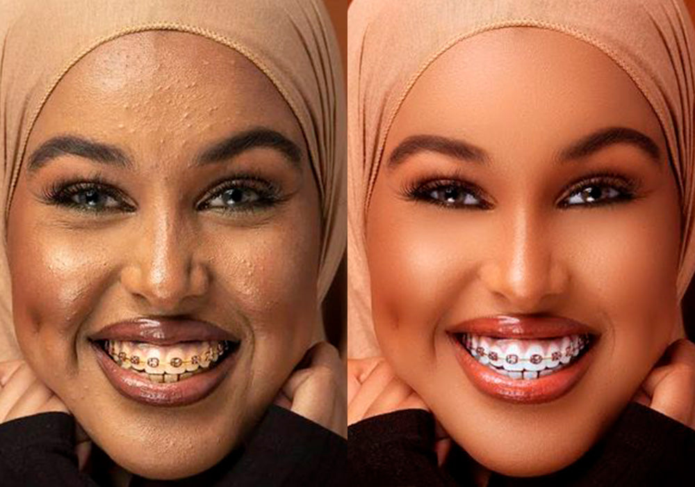 dental photography before after