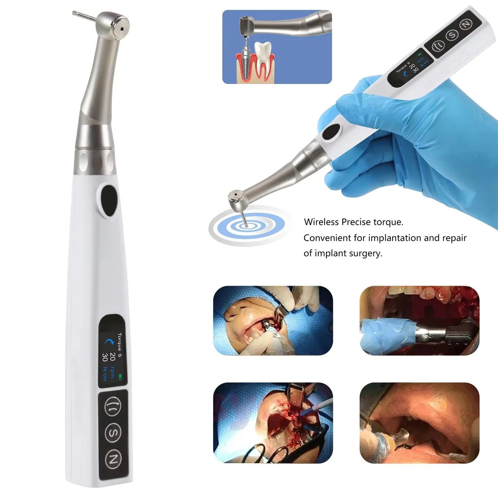 Electric Dental Implant Torque Wrench – Wireless & Precision-Controlled