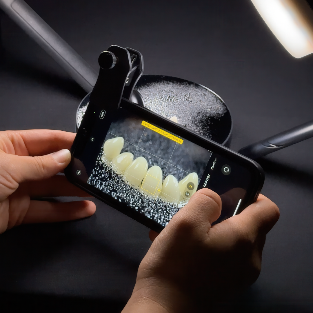 Mobile Kit for Dental Macro and Subject Photography