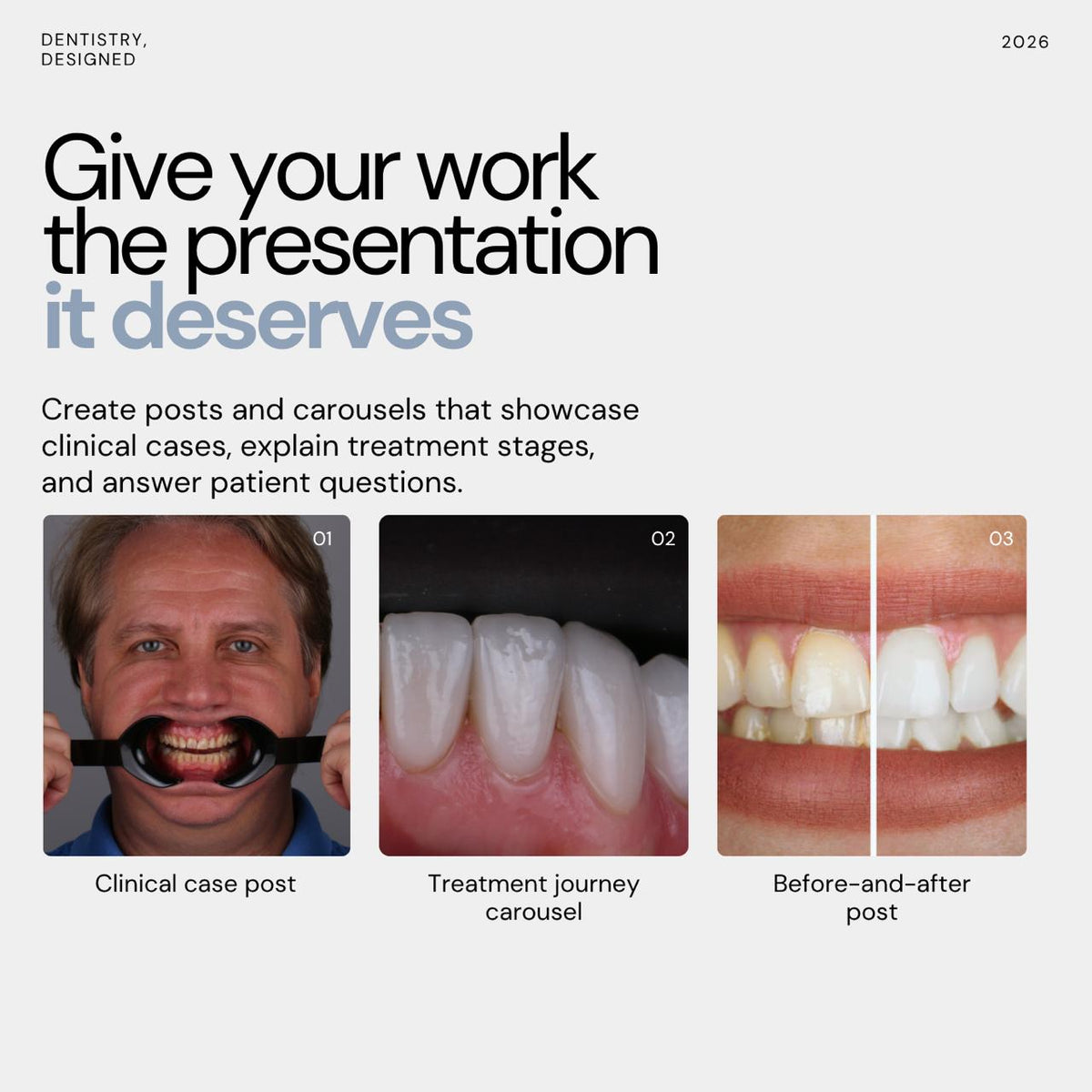 Course: Canva Dental Content Studio (Pre-order now for $59. Course open 1st october)