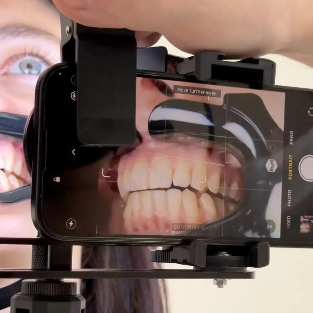 NEW! Dentiphoto Mobile Twin Light for Dental Photography Dentiphoto