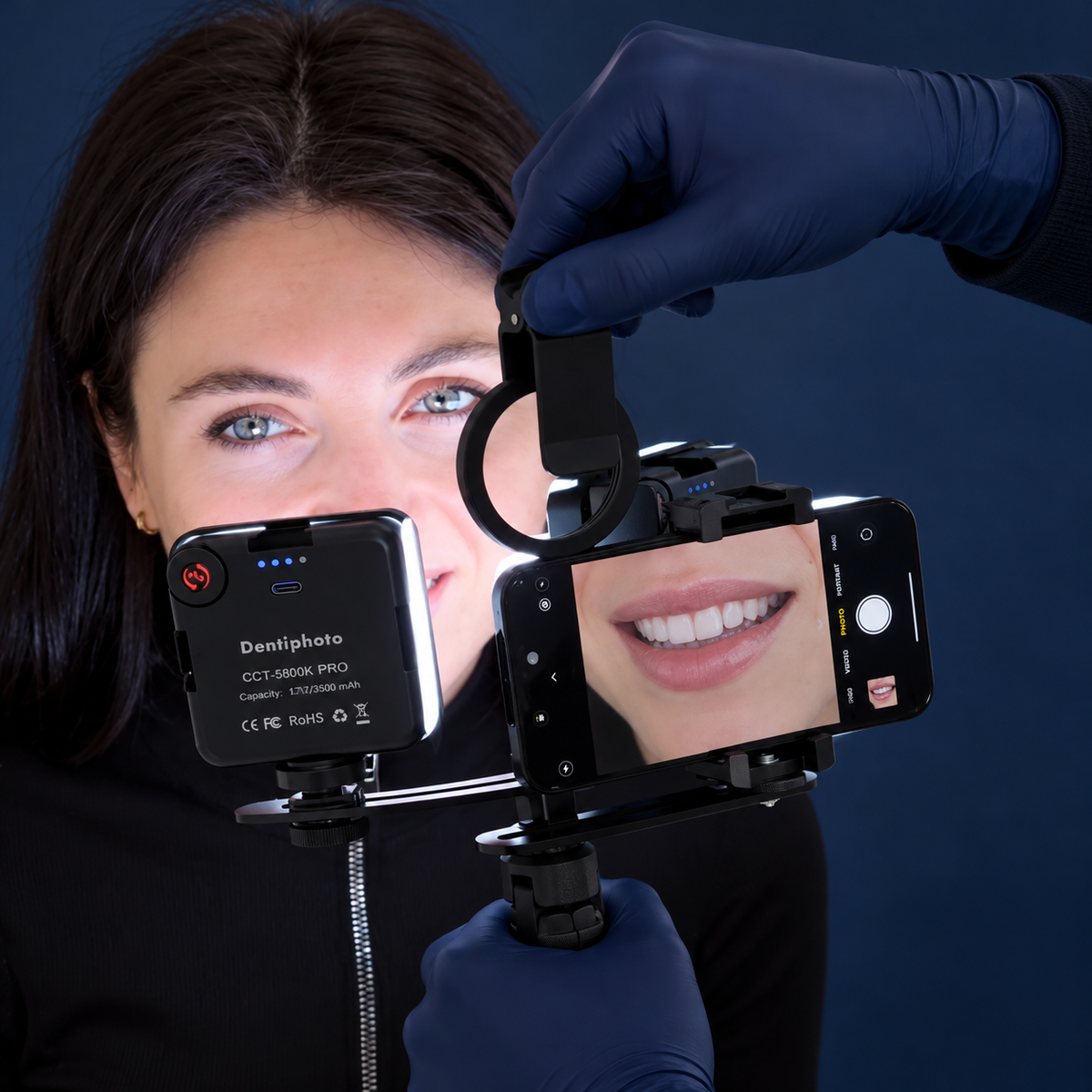 Dentiphoto Twin Light スマートフォン歯科撮影用 — 100 mmマクロレンズ・CPLフィルター付きデュアルLED、USB-C