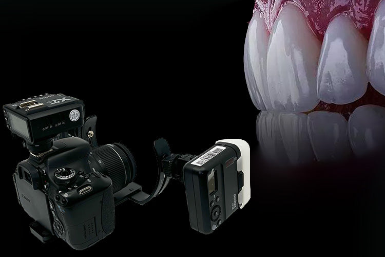 Dual Flash Bracket for Dental Photography - Dentiphoto
