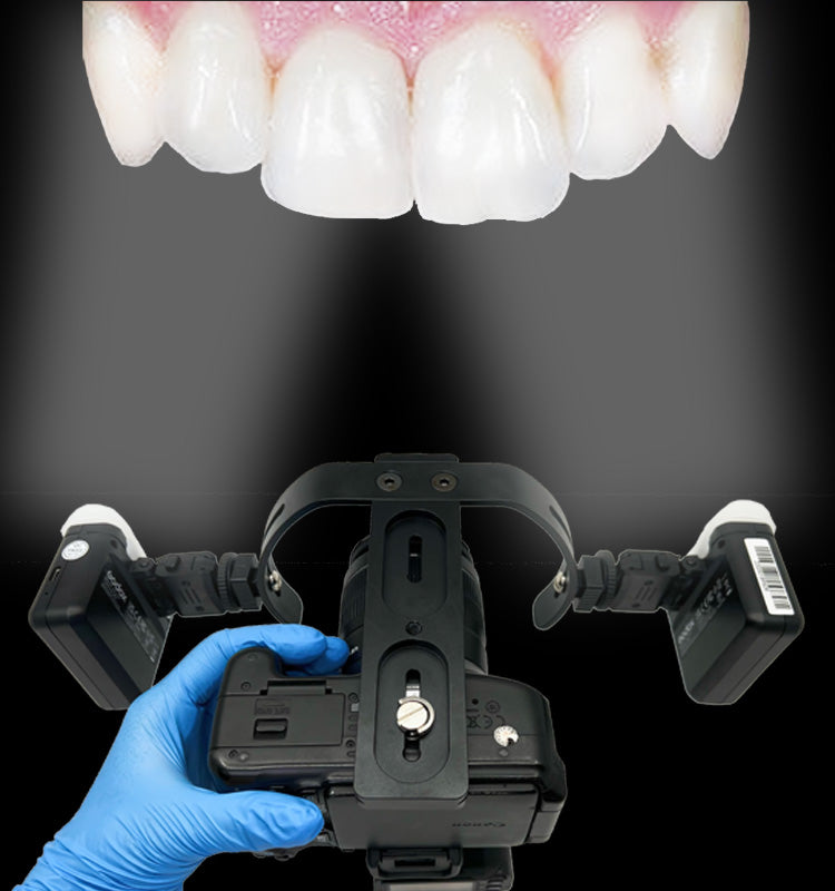 Dual Flash Bracket for Dental Photography - Dentiphoto