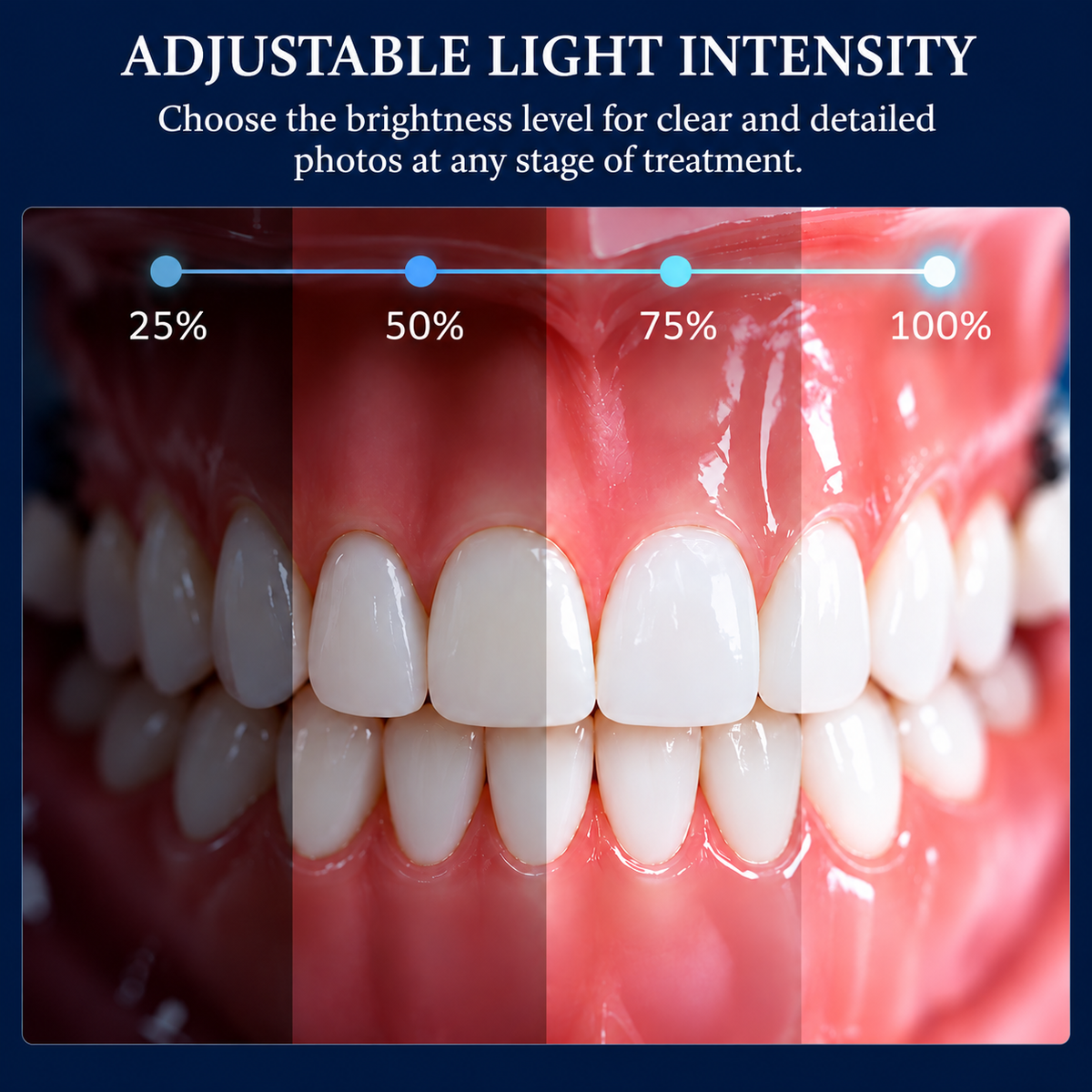 ProLight X Lámpara LED móvil para fotografía dental.