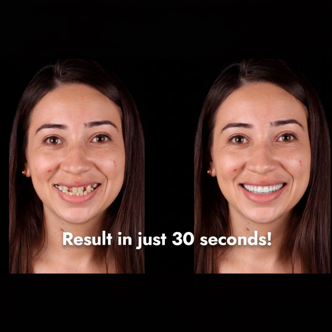 Special offer! Credits for Dentiphoto App with 50% discount! Christmas Offer Dentiphoto