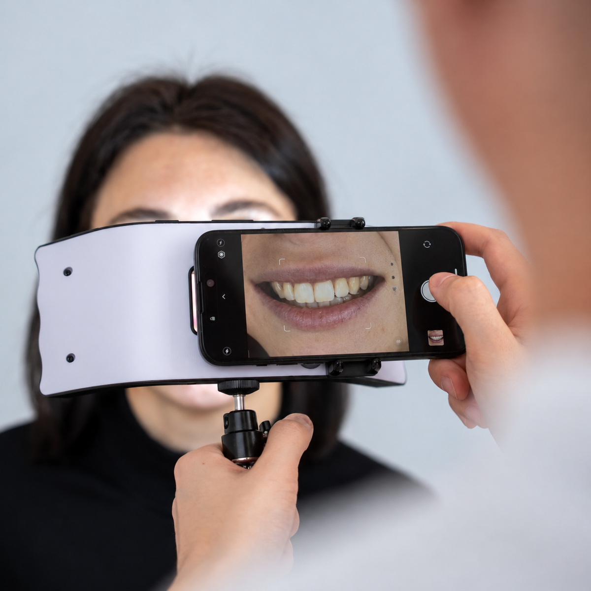 Ultra Light for Smartphone Dental Photography — 100 W, 128 LED Beads, 5500 K Daylight, 219 g