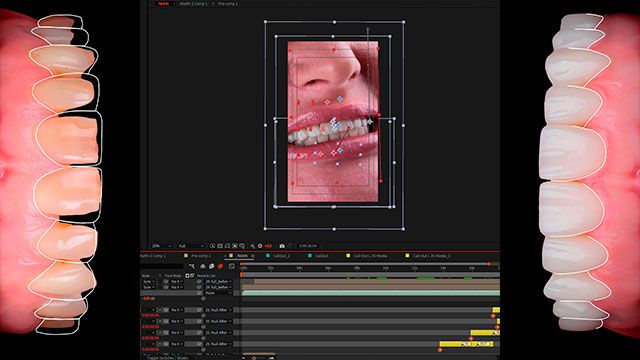 Diseño de movimiento dental AZ en After Effects (Español)