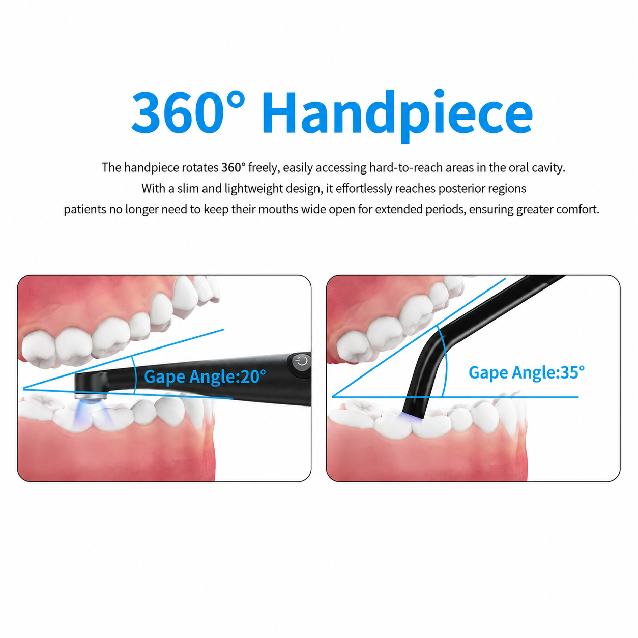 360 degree rotating handpiece lowers the required gape angle from 35 to 20 degrees when curing posterior teeth