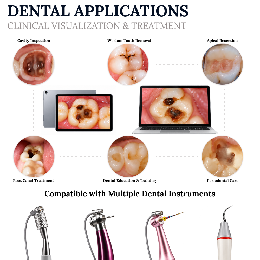 HD Root Canal Micro Camera – Precision Endodontic Visualization