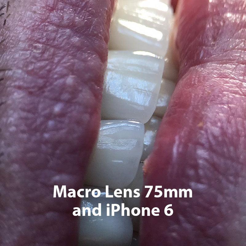 Phone Macro Lens 75mm - DENTIPHOTO.COM