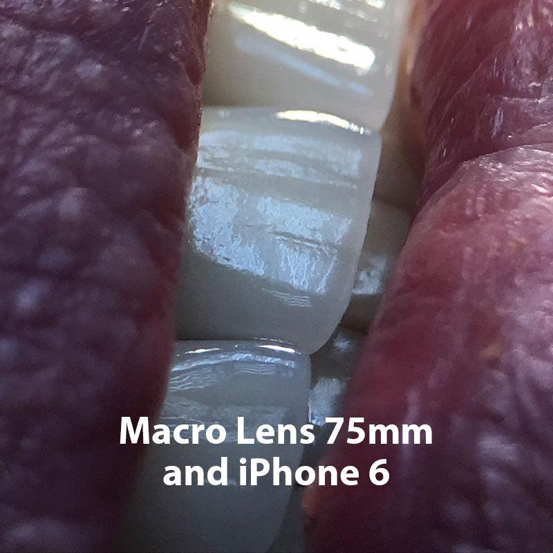 Phone Macro Lens 75mm - DENTIPHOTO.COM